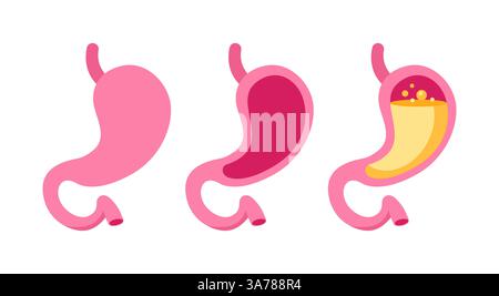 Set von stilisierten Magensymbolen in rosa Tönen, die verschiedene zustände der Magengesundheit und -Bedingungen darstellen Stock Vektor