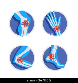 Satz von Gelenken Schmerzsymbole zeigen Symptome von Arthritis, Osteoporose, Rheumatoid, Gicht, Knie, Handgelenk-, Ellenbogen-, Sprunggelenkverletzung. Stock Vektor