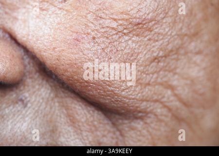 Nahaufnahme der alten Haut mit Textur und Details im Gesicht Stockfoto
