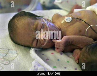 Preana Khamsa die Erstgeborene der identischen Vierermädchen gähnt nach einer Fütterungssitzung in der Spezialpflegesituation des Sutter Memorial Hospital, Mittwoch, 10. April 2002. Die Kinder wurden am Montag, 25. März 2002 als Tochter von Ornsee Khamsa, einer 22-jährigen Laotin, und Verek Muy, einem 20-jährigen Kambodschaner aus West Sacramento geboren. Sacramento Bee/Jay Mather/ZUMA Press Stockfoto