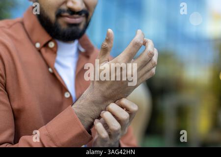 Ein Mann kratzt sich am Handgelenk, möglicherweise aufgrund von Juckreiz oder Unwohlsein. Der Fokus liegt auf seinen Händen und einem Teil seines Gesichts. Stockfoto