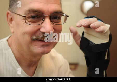 18. Dezember 2009 – Gilbert, Arizona, USA – Ärzte sagen, dass Timothy Blazer durch schnelles Denken seine linke Hand wieder befestigen konnte, nachdem er sie versehentlich mit einer Gehrungssäge durchtrennt hatte. Blazer, 52 Jahre alt, Schnitt ihm die linke Hand ab, während er an Schränken in seinem Haus in Gilbert, Arizona arbeitete. Nach dem Unfall hatte Blazer die Geistesgegenwart, seine abgetrennte Hand zu heben und sie auf Eis zu legen. Blazer sagt, dass sein Hintergrund bei den Pfadfindern und seine Ausbildung als Sicherheitsdirektor für Macy's ihm geholfen haben, ruhig zu bleiben. Chirurgen am Scottsdale Healthcare Hospital haben die Hand in einer vierstündigen Operation wieder befestigt und er hat Bewegung in allen Stockfoto