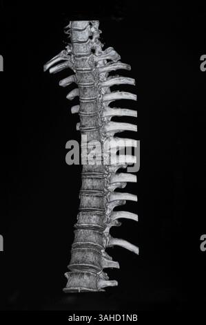 Spinale mrt-Bilder Stockfoto