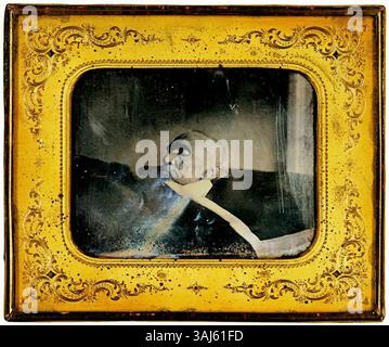 Philipp Petris Daguerreotypie von 1855 fängt den verstorbenen Mathematiker Carl Friedrich Gauß auf seinem Totenbett in Göttingen mit einem dekorativen Metallrahmen ein. Stockfoto