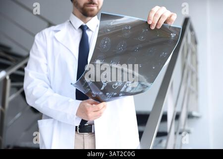Arzt untersucht Gehirn-MRT in Klinik, Großaufnahme Stockfoto