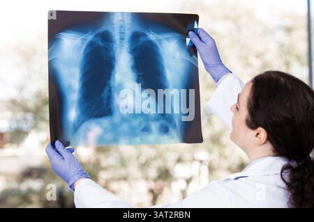 Junge Ärztin, die eine Thoraxröntgenaufnahme eines Patienten mit langer covid im Krankenhaus analysiert. Stockfoto