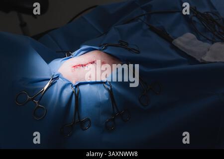 VET-Frau näht die Operationswunde eines Hundes unter Narkose nach Operation in einer Tierklinik. Veterinärmedizinisches Konzept. Stockfoto