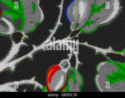Eine abstrakte Komposition mit ineinander verflochtenen organischen Formen, mit leuchtenden Farben, die durch ein Gewirr aus dunklen Linien und Formen hindurchschauen, was ein Gefühl von Tiefe und Bewegung erzeugt. Ein lebendiges Muster mit grünen Blättern und bunten Eicheln, die auf einem dunklen Hintergrund aufwendig gewebt sind, schafft ein lebendiges, florales Design. Klassische Kunst mit einem modernen Twist von Artotop, transformierte französische Stoffe, erste Hälfte des 19. Jahrhunderts, klassische Kunst mit einem modernen Twist von Artotop Stockfoto