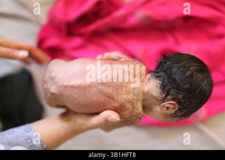 06. Januar 2010 - Lashkargah, Helmand, Afghanistan - die Kinderstation in einem Krankenhaus. (Bild: © Ton Koene/ZUMApress.com) Stockfoto