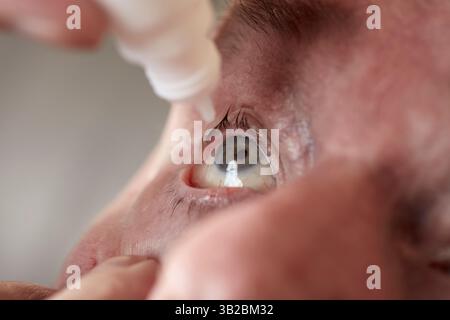 Ein älterer Mann, der sich Augentropfen verabreicht. Stockfoto