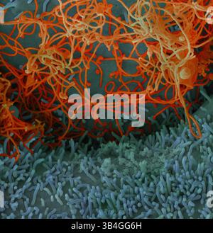 11. Dezember 2014 - Atlanta, Vereinigte Staaten von Amerika - mikroskopische Ansicht des Ebola-Virus aus einer Blutprobe des Mali-Opfers. Farbiges Rasterelektronenmikrogramm filamentöser Ebola-Viruspartikel, die an einer chronisch infizierten VERO-E6-Zelle gebunden sind und aus ihr heraus wachsen. (Kreditbild: © NIAID via ZUMA Wire) Stockfoto