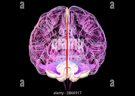 Abbildung eines menschlichen Gehirns (Vorderansicht) mit hervorgehobenen Falx cerebri (orange) und Tentorium cerebelli (violett), die die Schutzmembranen des Gehirns zeigen. Stockfoto