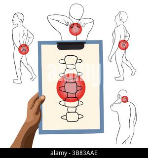 Vektorisolierte Darstellung der Wirbelsäulenschmerzbehandlung. Rheumatherapie. Rehabilitation. Wirbelsäulenverletzungen. Stock Vektor