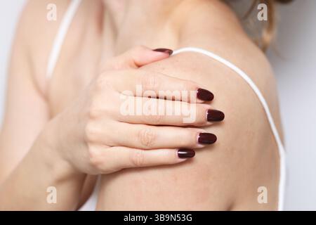 Frau berührt Wunde Schulter. Gelenkschmerzen. Hautreizungen und Muskelbeschwerden. Frau mit dunklen Nägeln, die die Schulter halten. Gesundheitsproblem. Stockfoto