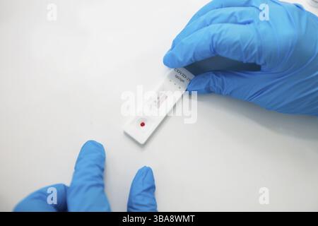 Die Hände des Arztes halten einen Expresstest auf Coronavirus Stockfoto