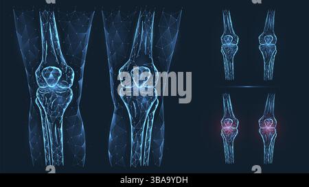 Abstrakte polygonale Darstellung der menschlichen Knieanatomie. Erkrankung, Schmerz und Entzündung der Kniegelenke isoliert auf blauem Hintergrund Stockfoto