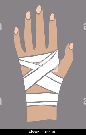 Vektorisolierte Darstellung einer bandagierten Hand. Erste Hilfe bei Handverletzungen. Stock Vektor
