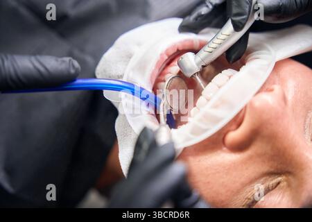 Nahaufnahme-Zahnarzt zur Entfernung von Zahnbelag und Zahnstein mit Wasserstrahl Stockfoto