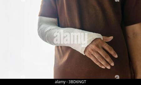 Eine Nahaufnahme des Arms einer Person, umhüllt von einem weißen Gipsguss, der sich direkt unter dem Ellenbogen erstreckt, um die Hand zu bedecken, wobei die Finger freigelegt sind. Stockfoto