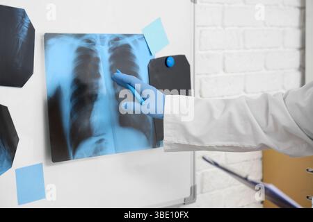 Arzthand mit Röntgenaufnahme der Lunge auf Magnetplatte in der Klinik, Nahaufnahme Stockfoto