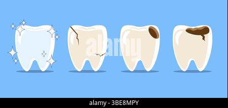 Gesunde Zähne, Zahnrisse, Karies oder Karies. Satz von flacher Zeichentrickzeichnung. Isoliert auf blauem Hintergrund. Vektor . Stock Vektor
