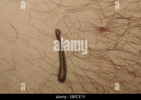 Blutegelbiss (Hirudinea) Stockfoto