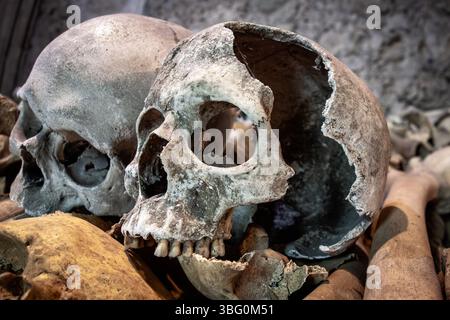 Ein gebrochener und gebrochener menschlicher Schädel, ausgestellt in der Crypt St Leonard's Church Hythe, Kent, Großbritannien Stockfoto