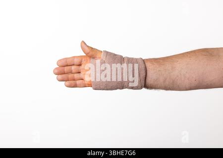 Hand und Handgelenk eines Mannes in einen Tuchverband gewickelt nach Karpaltunneloperation. Stockfoto