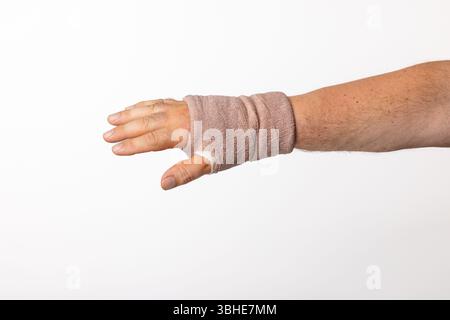Hand und Handgelenk eines Mannes in einen Tuchverband gewickelt nach Karpaltunneloperation. Stockfoto