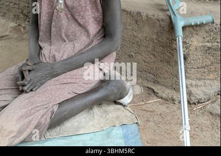 SÜDSUDAN, Bundesstaat West Bahr el Ghazal, Stadt Wau, Dorf Agok für Leprakranke / SÜDSUDAN, Wau, Agok Lepradorf der DAHW Stockfoto