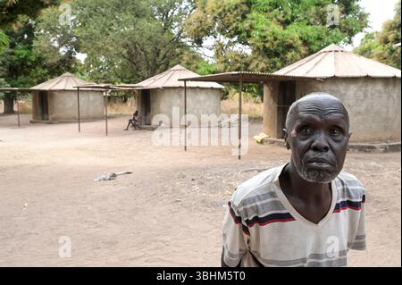 SÜDSUDAN, Bundesstaat West Bahr el Ghazal, Stadt Wau, Dorf Agok für Leprakranke / SÜDSUDAN, Wau, Agok Lepradorf der DAHW Stockfoto
