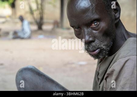 SÜDSUDAN, Bundesstaat West Bahr el Ghazal, Stadt Wau, Dorf Agok für Leprakranke / SÜDSUDAN, Wau, Agok Lepradorf der DAHW Stockfoto