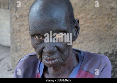 SÜDSUDAN, Bundesstaat West Bahr el Ghazal, Stadt Wau, Dorf Agok für Leprakranke / SÜDSUDAN, Wau, Agok Lepradorf der DAHW Stockfoto