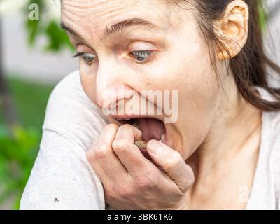 Eine Nahaufnahme einer Hirschzecke, die am Arm einer Person herumkriecht. Die Arachnide ist rötlich gefärbt und hat ihre Beine als Kriechen ausgestreckt Stockfoto