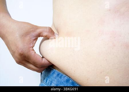 Adipositas Mann Körper, fette männliche Bauch, Eine Hand drückt das überschüssige Fett auf dem Magen einer Person und hebt Probleme der Adipositas oder des Körpergewichts hervor. Stockfoto