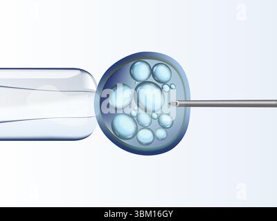 IVF (in-vitro-Fertilisation) Stockfoto