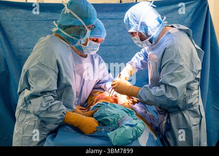 Die Platzierung einer Hüftprothese mit Roboterunterstützung am Lyon-Sud-Krankenhaus. Stockfoto