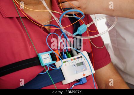 Patientenüberwachung mit Holter-Schreiber: Medizinisches EKG-Herzfrequenzmessgerät, das mit Drähten und Bildschirm an der Brust befestigt ist Stockfoto