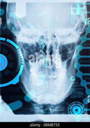 Digital erzeugte Röntgenaufnahme des menschlichen Schädels Stockfoto