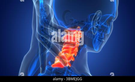 Menschliches Leiden mit starken Schmerzen in der Halswirbelanatomie Stockfoto
