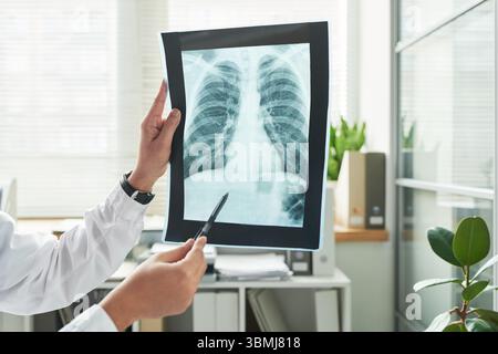Kaukasischer Arzt hält und analysiert Röntgenaufnahme der Brust in der medizinischen Praxis, mit Stift auf bestimmten Bereich auf der Röntgenaufnahme zeigen, Ergebnisse mit besprechen Stockfoto