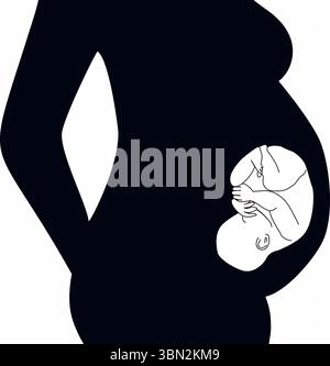 Schwangerschaft mit Baby-IVF (in vitro Fertilisation)-Fertilitätssilhouette Stockfoto