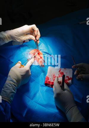 Dermatologische Chirurgie im OP. Die Endnaht einer Operationswunde. Plattenepithelkarzinom. Die Hände eines Chirurgen und seiner Assistentin int Stockfoto