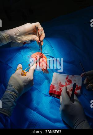 Dermatologische Chirurgie im OP. Naht einer chirurgischen Wunde. Plattenepithelkarzinom. Die Hände eines Chirurgen und seines Assistenzarztes Stockfoto
