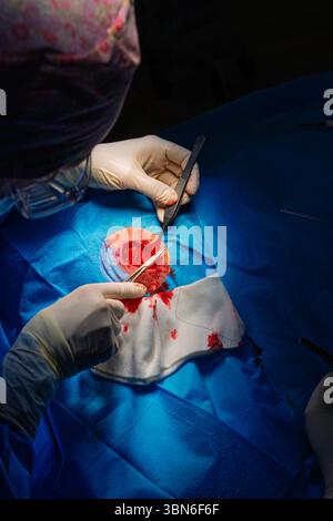 Dermatologische Chirurgie im OP. Die Naht einer chirurgischen Wundverletzung. Plattenepithelkarzinom. Die Hände eines Chirurgen und seiner Assistentin Stockfoto