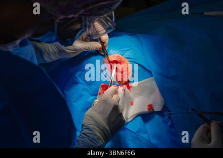 Dermatologische Chirurgie im OP. Die Naht einer chirurgischen Wundverletzung. Plattenepithelkarzinom. Die Hände eines Chirurgen und seiner Assistentin Stockfoto