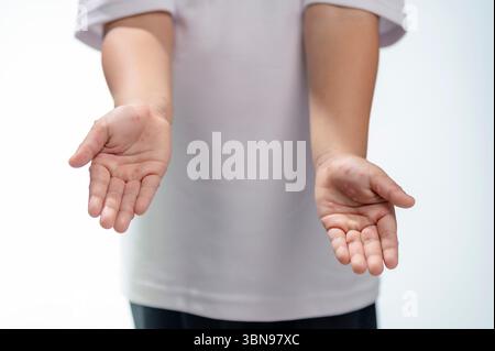 Hand-, Maul- und Klauenseuche HFMD menschliche Hand des Scharlachfiebers beim Coxsackievirus palmarosa Virus und Kinderhand auf weißem Hintergrund Stockfoto