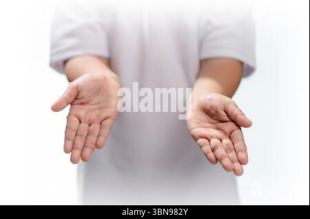 Hand-, Maul- und Klauenseuche HFMD menschliche Hand des Scharlachfiebers beim Coxsackievirus palmarosa Virus und Kinderhand auf weißem Hintergrund Stockfoto