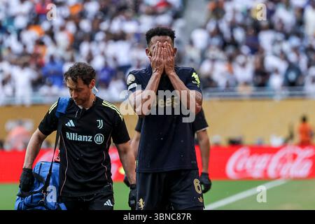 Orlando, Usa. Juli 2025. Orlando, Vereinigte Staaten von Amerika, 1. Juli 2025: Lloyd Kelly 6 Juventus reagiert beim Achtelfinale der FIFA Club-Weltmeisterschaft, Spiel zwischen Real Madrid CF und Juventus FC im Hard Rock Stadium am 1. Juli 2025 (João Bravo /SPP) Credit: SPP Sport Press Photo. /Alamy Live News Stockfoto