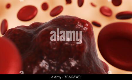 Eine 3D-Darstellung einer Blutprobe, die eine Krebsbildung enthält und eine Darstellung eines Bluttumors oder einer bösartigen Zelle liefert. Stockfoto